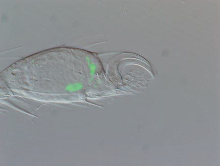 Distal Tip of a Drosophila Limb (DIC&GFP)